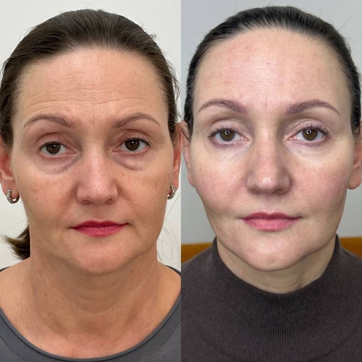 Nolever régulateur de cortisol