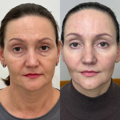 Nolever régulateur de cortisol