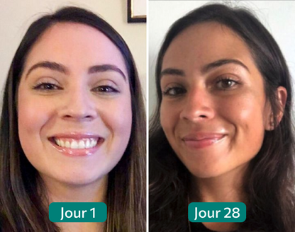 Nolever régulateur de cortisol